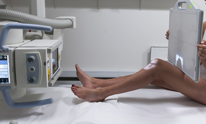 Thumb susanne axial patella ligge